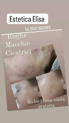 Immagine Elisa Sanna estetica e welness 3