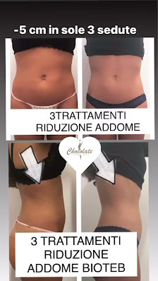 Immagine Chocolate Bergamo Estetica & Solarium 3