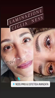 Immagine Ness.Pmu e estetica avanzata 3
