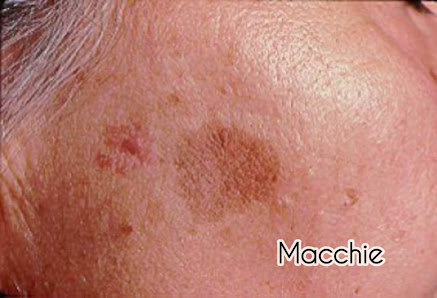 Immagine Corpofollia 1