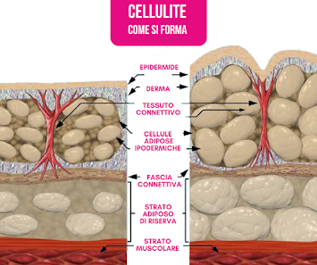 Immagine Cherie Centro Estetico - Rimodella il Tuo corpo in 4 settimane! 2