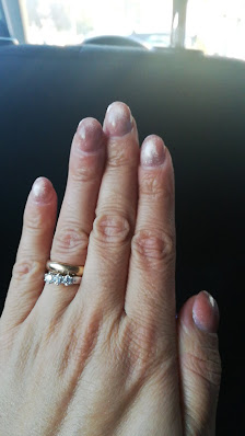 Immagine Raggio Di Sole Centro Estetica 3