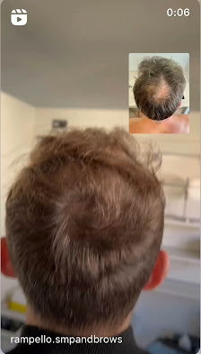 Immagine RAMPELLO SMP | Tricopigmentazione Chieri (Torino) 3