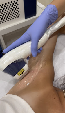 Immagine DepilBody 2