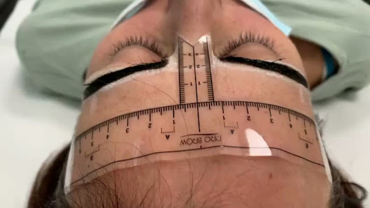 Immagine Estetica DermoLaser SLO 3