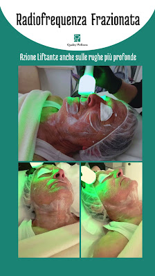 Immagine Quality Wellness Centro Estetico Frosinone 3