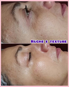 Immagine Dermoestetika 2