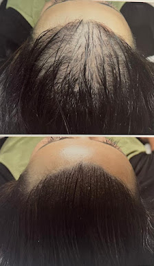 Immagine Le Reve de Rori 2