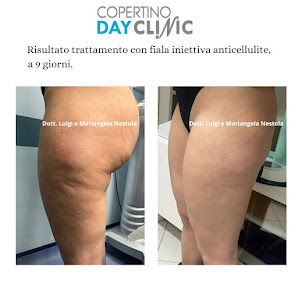 Immagine Chirurgia Estetica Nestola 3