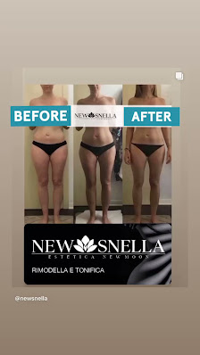 Immagine New Snella - Centro modellamento corpo 1