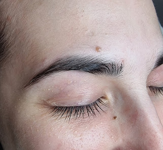 Immagine Alveda Epilazione Definitiva 1