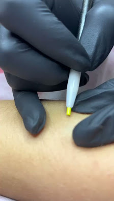 Immagine Alveda Epilazione Definitiva 5