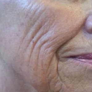 Immagine Estetica 1 Classe Bologna 3