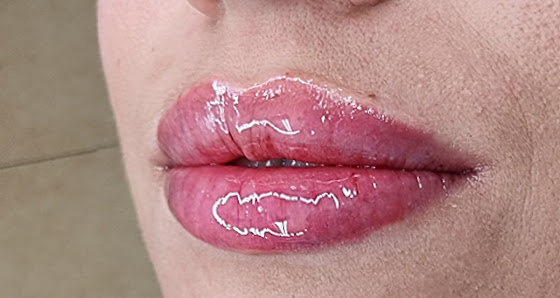 Immagine Dr.ssa Rosa Salutari Medico Estetico | Taranto & Milano | Filler Labbra, Botox, Biorivitalizzazione 1