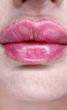 Immagine Dr.ssa Rosa Salutari Medico Estetico | Taranto & Milano | Filler Labbra, Botox, Biorivitalizzazione 3