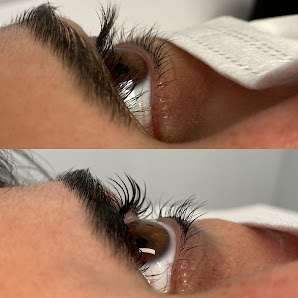 Immagine Isola Lu Centro Estetco 1