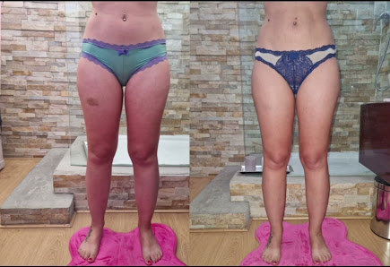 Immagine Belli Si Puo' centro estetico 1