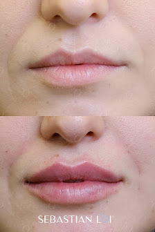 Immagine Sebastian Loi | Medicina Estetica Conegliano 2