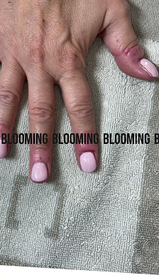 Immagine Blooming 4