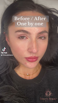 Immagine TRISCELE Beauty 5