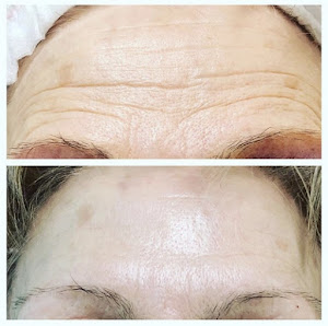 Immagine Dott. Gino Ferroni, Medico estetico 1