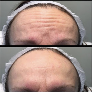 Immagine Dott. Gino Ferroni, Medico estetico 2