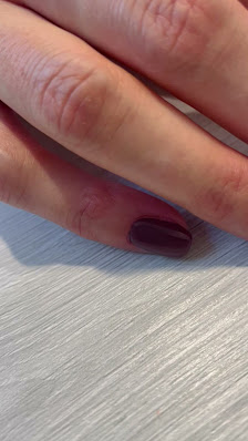 Immagine Estetica Perla Nera 2