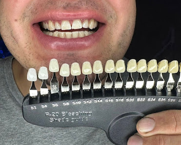 Immagine White Diamonds 1