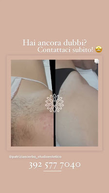 Immagine Patrizia Scerbo Centro Estetico 5