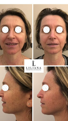 Immagine Liliana Estetica Avanzata 3