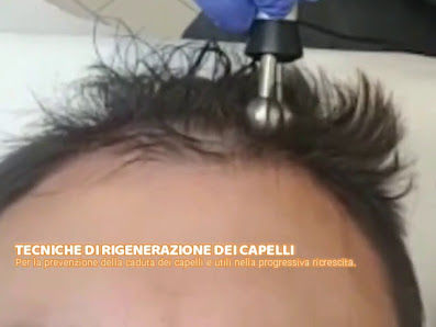 Immagine Silvia Sgalippa _ Tricopigmentazione - Beauty Coach - Antiaging Advisor 3