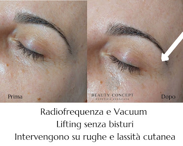 Immagine Beauty Concept | Centro Estetico | Epilazione Laser | Anticellulite | Massaggi | Dermopigmentazione Sopracciglia | Conversano 3
