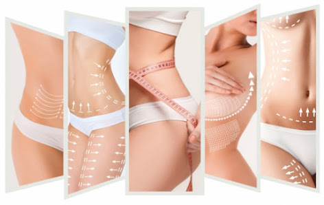 Immagine Chicchissima 1