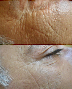 Immagine So Beauty 1