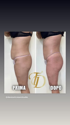 Immagine Denise Troiani Studio 2