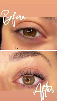 Immagine LA SUITE DEL BENESSERE 5