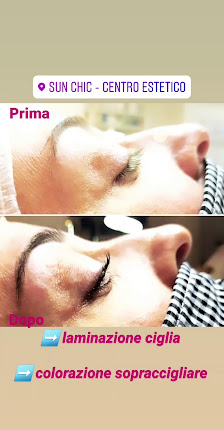 Immagine SunChic Solarium 4