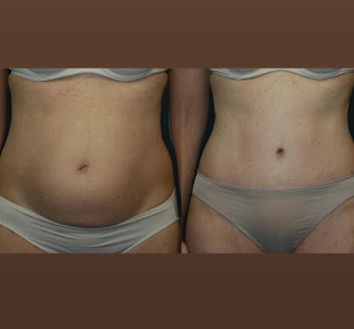 Immagine Marama Clinic 2