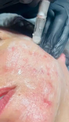 Immagine Estetica Tiffany 3