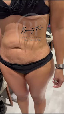 Immagine BEAUTY CLINIC SAN DONATO 2