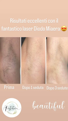 Immagine Alestetica 3