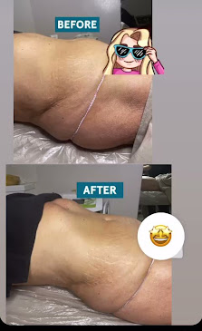 Immagine Alba Centro Benessere 3