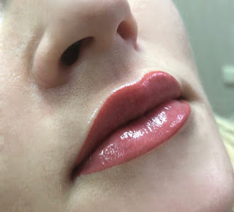 Immagine BeB Anteprima 3