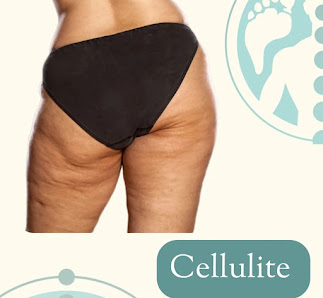 Immagine Massaggio Linfodrenate e Drenante, Extension -Laminazione ciglia, BB Glow, Kissum, HyaluronPen, 2