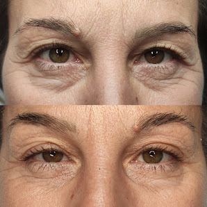 Immagine Sonia Di Lauro Truccosemipermanente Estetica 5