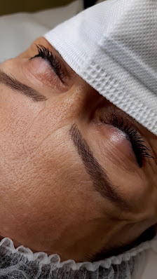 Immagine Piume Estetica 4