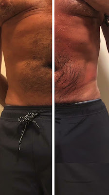 Immagine Ony centro estetico 3