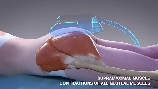 Immagine Venere medi SPA 3