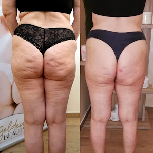 Immagine Golden Beauty "Gli Specialisti Del Rimodellamento Corpo" 2