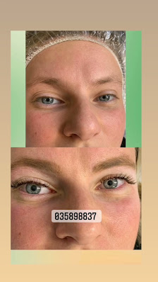 Immagine Anna Estetista Trucco Semipermanente microblading estetica specialistica Microneedling cicatrici trattamento acne unghie gel 3